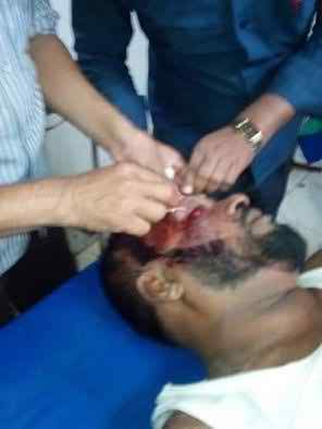 ফেনীতে আ’লীগ নেতাকে কুপিয়ে মোটর সাইকেল ছিনতাই