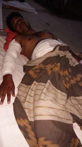 সোনাগাজীতে শোক দিবসের মাইক লাগাতে গিয়ে ৪ জন বিদ্যুতপৃষ্ট