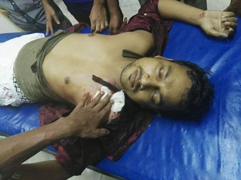 সোনাগাজীতে যুবলীগ নেতার গুলিতে স্বেচ্চাসেবকলীগ নেতা গুরতর আহত