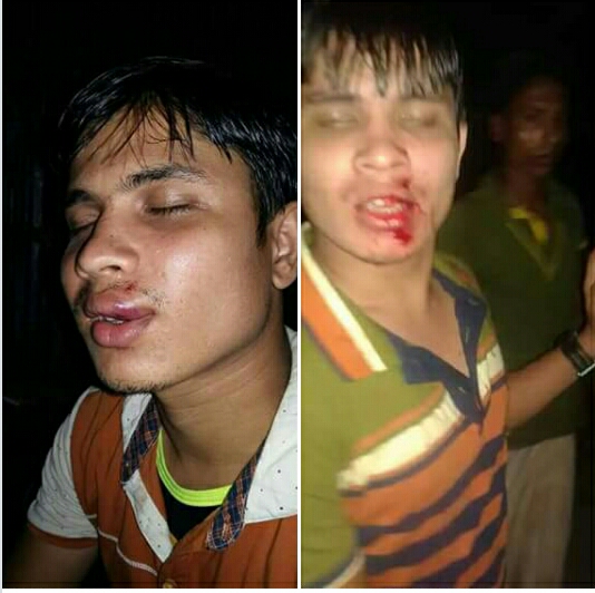 ছাত্রলীগ সম্পাদকের উপর হামলা।।ভুয়া নাটকে ফেসে যাচ্চেন বাচ্চু মেম্বার!