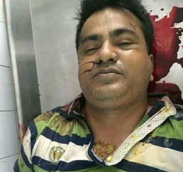 আটকের পর কথিত ‘বন্দুকযুদ্ধে’  সাভার পৌর যুবদলের সাংগঠনিক সম্পাদক নিহত