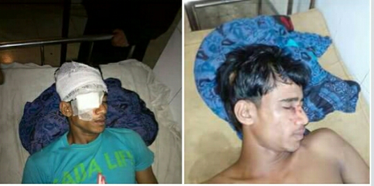 সোনাগাজীতে সিরাজ হাজারীর হামলায় এক যুবক গুরতর আহত