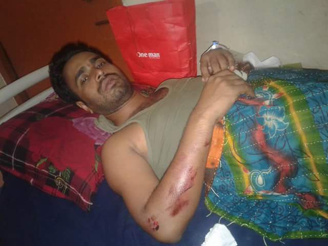 সোনাগাজী উপজেলা ছাত্রলীগের সহ-সভাপতি জলিল সড়ক দুর্ঘটনায় অাহত