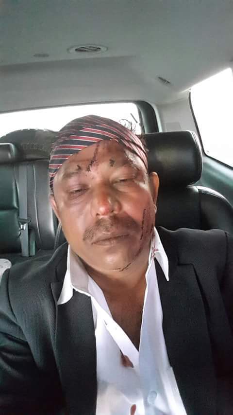 সৌদি প্রবাসী বিএনপি নেতা সেলিম রেজা সড়ক দূর্ঘটনায় আহত