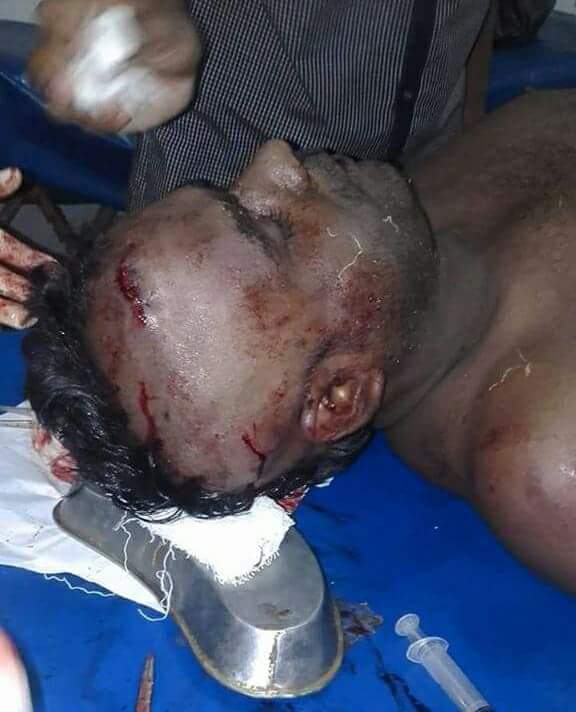 ফেনীতে পূর্ব শত্রুতার জেরে যুবলীগ নেতাকে  কুপিয়ে হত্যার চেষ্টা